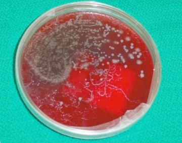 Strongyloides stercoralis larva tracks on a blood agar plate from the bronchoalveolar lavage of a patient with disseminated strongyloidiasis (taken from Sue Lim et al.3)