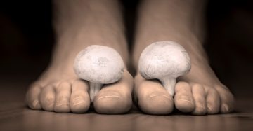 Mushrooms between the toes feet imitating nail fungus