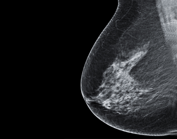 Understanding breast cancer responsivnes