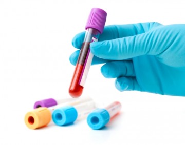 Direct-to-Consumer genetic testing: What it means for the general practitioner