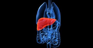 Use of non-invasive tests for liver fibrosis