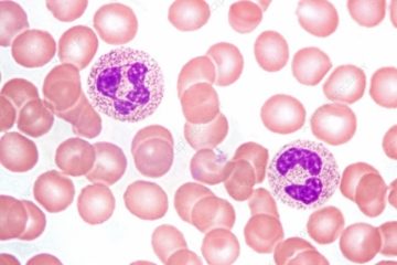 Normal peripheral blood smear